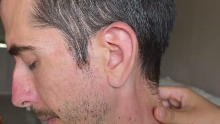 Head & Scalp Massage YouTube video thumbnail