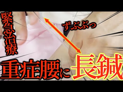 【吸い玉 整体】アラサー女子 ガチガチの腰、瘀血で股関節も発症 吸い玉と長い鍼を奥に入れ治す 自宅で改善できるツボ療法もお伝えします【東京銀座 横浜元町 美容鍼灸】