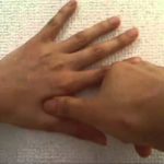 腱鞘炎・ばね指の親指の痛みを和らげる方法