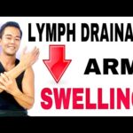 Lymphatic Drainage or Massage for Swollen Arm