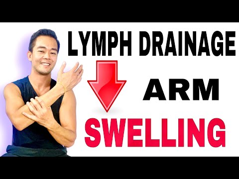 Lymphatic Drainage or Massage for Swollen Arm