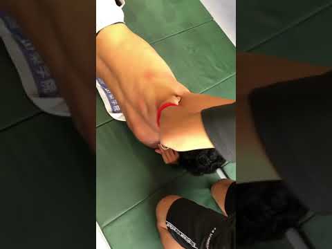 投手　肩痛　肩のコンディショニング　ACT手技療法