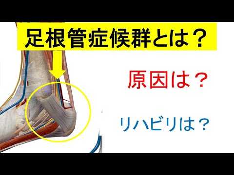 足根管症候群の症状と治療、リハビリテーションの解説
