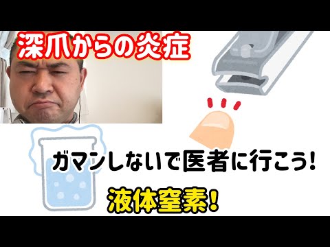 【痛い！】足の指の付根、膿んだ。