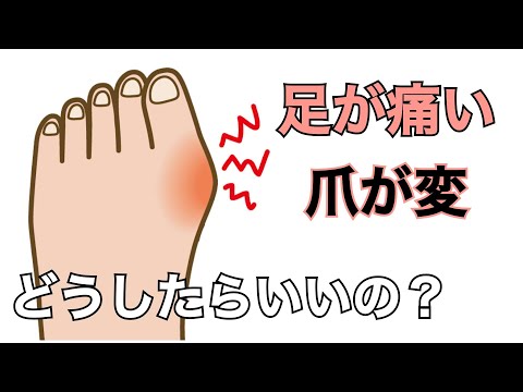 足の痛みや爪のトラブルについて