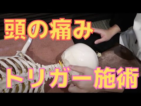 頭頂部の痛みに対するトリガーポイント施術