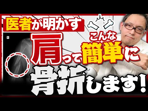 【驚愕】意外すぎる肩の骨折エピソード3選
