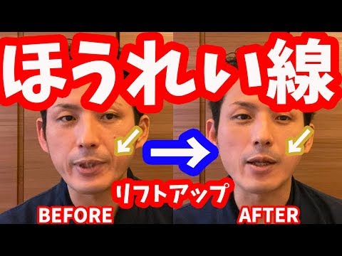 【初公開】ほうれい線・リフトアップに効く「側頭筋リリース」【大分市 腰痛治療家 GENRYU ( 安部元隆 )】Reduce the laugh lines with GENRYU's METHOD
