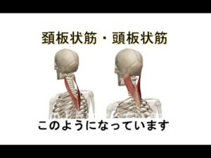 図解 ＝ 頚板状筋・頭板状筋 　【首の後ろの痛み】