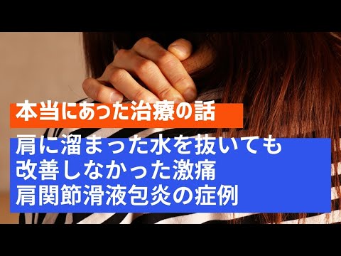 【本当にあった治療の話】肩に溜まった水を抜いても改善しなかった激痛。肩関節滑液包炎の症例