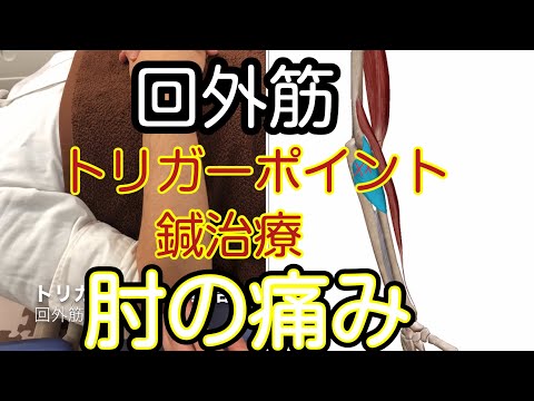 回外筋のトリガーポイント鍼治療、肘の痛みや親指の痛み