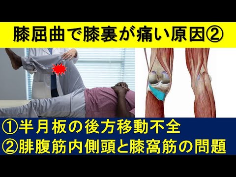 膝を曲げると膝の裏が痛い原因パート②半月板の後方移動不全、腓腹筋内側頭と膝窩筋の問題について解説