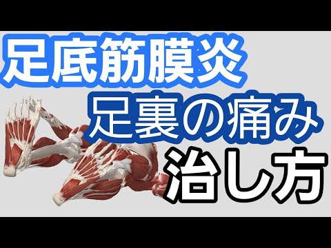 足裏の痛みの治し方【足底筋膜炎】plantar fasciitis treatment