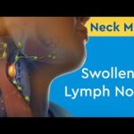 Neck Mass: Swollen Lymph Node