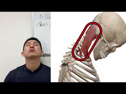 頭痛解消ストレッチ。原因は〇〇筋の疲労？