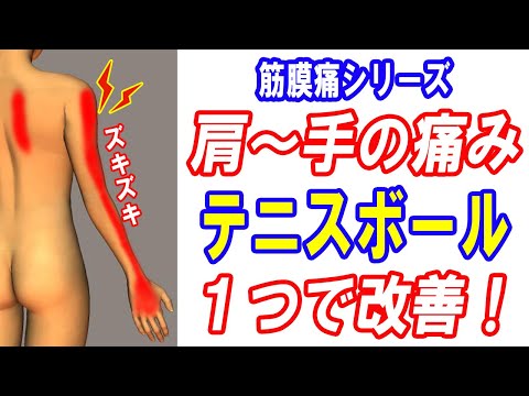 【腕の痛み】椎間板ヘルニア？テニスボール1つで改善させる！筋膜痛｜大和市の整体 中央林間カイロプラクティック