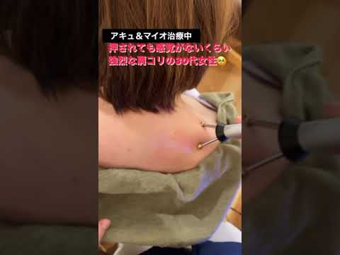 【ひどい肩コリ】岩のようにガチガチな肩コリを無痛に!【名古屋市千種区 本山整体サロン ゴルファー治療】