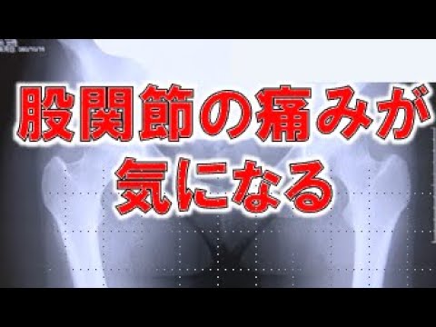 「股関節」の痛みが気になる…女性に多い「変形性股関節症」って？【医療のミカタ】
