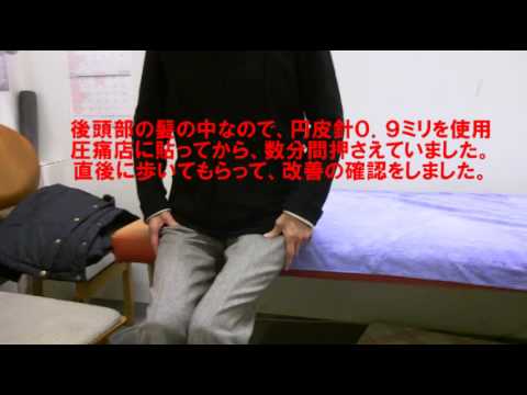 腰痛の原因は、頭の傷の圧痛