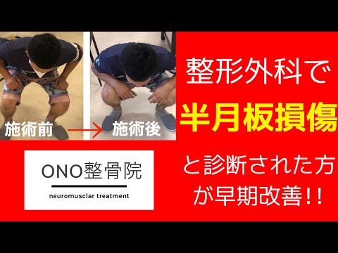 整形外科で半月板損傷と診断された膝の痛みが早期改善／ONO整骨院鹿児島市【本気で治したいあなたのための整骨院】