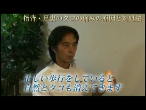 指背・足裏のタコの痛みの原因と対処法.mpg