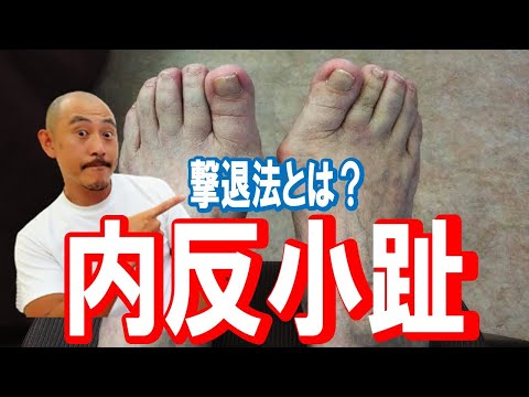 【内反小趾.寝ゆび】ここを押して痛い人はご注意を…【川崎市の外反母趾治療家 バイタルあきやま】