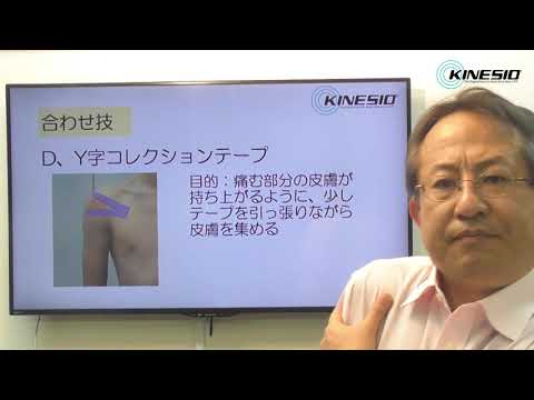 11.肩の前前方の痛みのキネシオテーピング