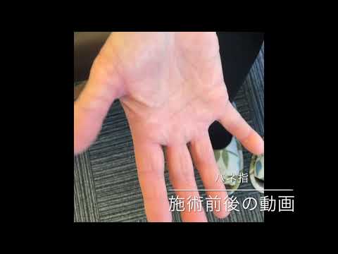 バネ指施術動画