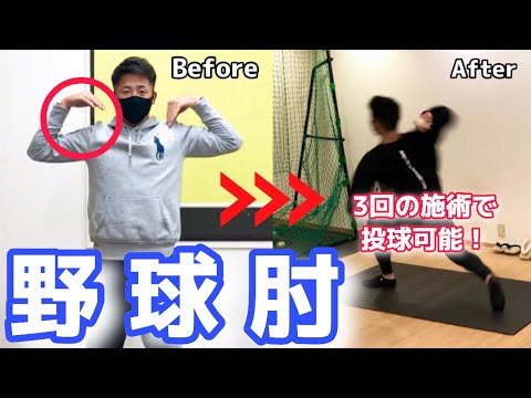 【野球肘】1年以上も肘の痛みで投球できない。治らない野球肘でお悩みの方必見！｜西宮市　小波津整体院