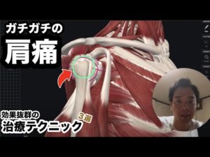 ガチガチの「肩痛」に効果抜群の治療テクニック３つはこれ！【肩の痛み 治し方 ストレッチ】3 fascial treatments to cure shoulder pain