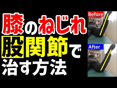 膝のねじれは股関節で簡単に治る!!【兵庫県 伊丹市 膝の痛み】