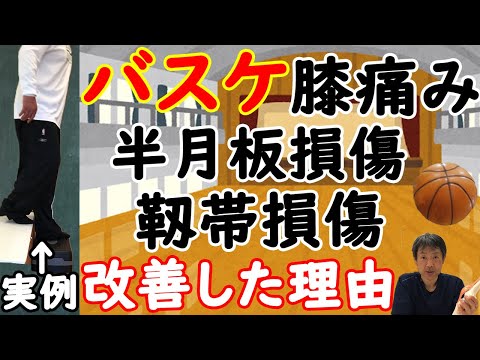 【バスケットボール】【膝の靱帯損傷、半月板損傷】ぶり返す痛み・腫れが改善した理由